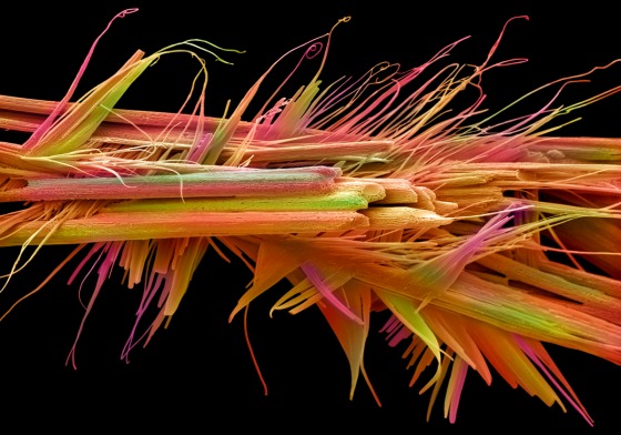 This false-coloured scanning electron micrograph (SEM) shows caffeine crystals.